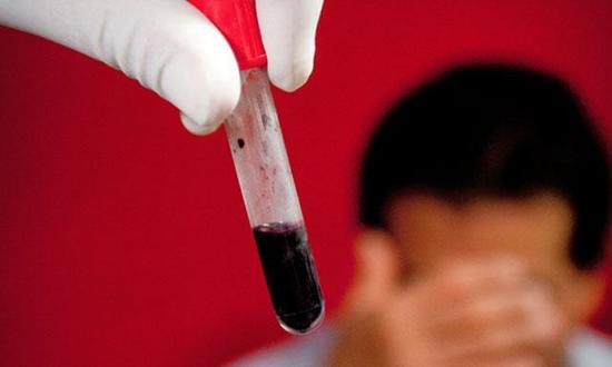 Discriminación en el ámbito laboral.