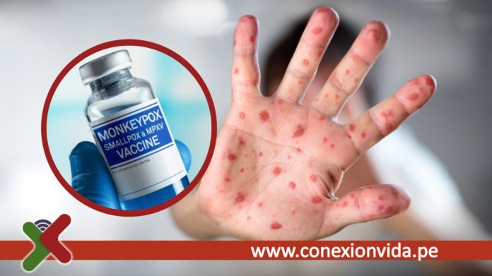 Holanda comenzó la vacunación contra la viruela del mono en poblaciones clave