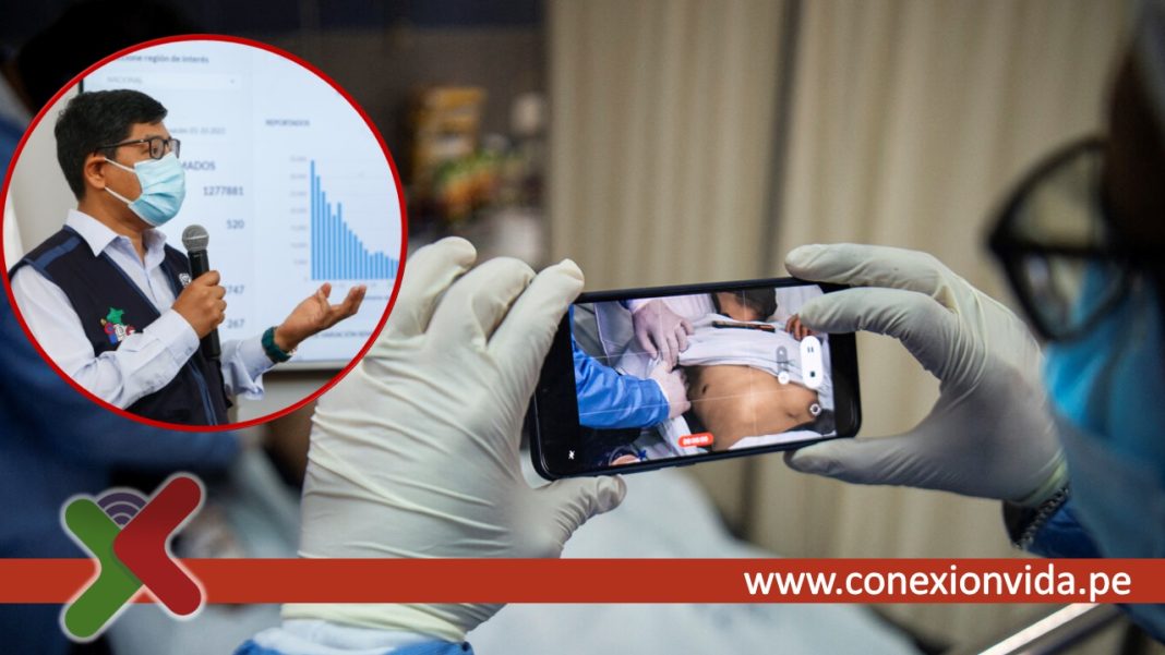 Viruela del mono y VIH / Foto: Ernesto Benavides - RPP Viruela del mono y VIH / Foto: Ernesto Benavides - RPP